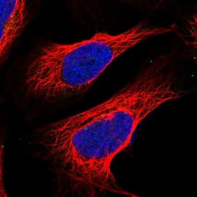 Immunocytochemistry/ Immunofluorescence: QPCTL Antibody [NBP1-82208]