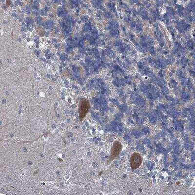 Immunohistochemistry-Paraffin: QPCTL Antibody [NBP1-82208]