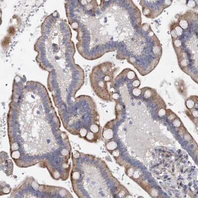 Immunohistochemistry-Paraffin: QPCTL Antibody [NBP1-82208]
