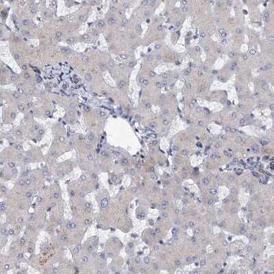 Immunohistochemistry-Paraffin: QPCTL Antibody [NBP1-82208]