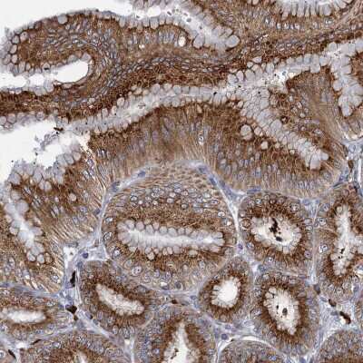 Immunohistochemistry-Paraffin: QPCTL Antibody [NBP1-82208]