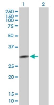 Western Blot: QPCTL Antibody [H00054814-B01P]