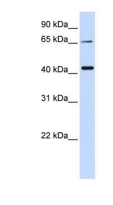 Western Blot: QPCTL Antibody [NBP1-62586]