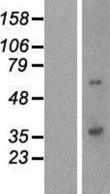 Western Blot: QPCTL Overexpression Lysate [NBP2-06952]