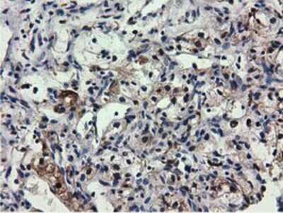 Immunohistochemistry-Paraffin: QPRT Antibody (OTI1C10) [NBP2-02860]