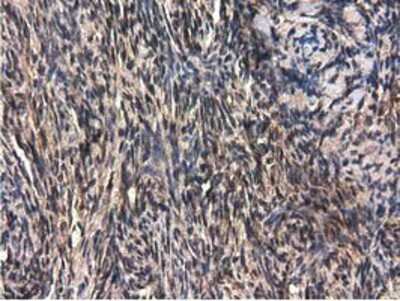 Immunohistochemistry-Paraffin: QPRT Antibody (OTI1C10) [NBP2-02860]