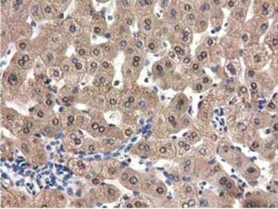 Immunohistochemistry-Paraffin: QPRT Antibody (OTI1C10) [NBP2-02860]