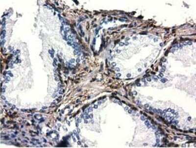Immunohistochemistry-Paraffin: QPRT Antibody (OTI1C10) [NBP2-02860]