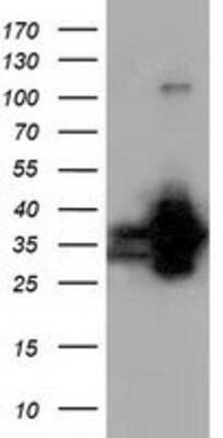 Western Blot: QPRT Antibody (OTI1C10) [NBP2-02860]