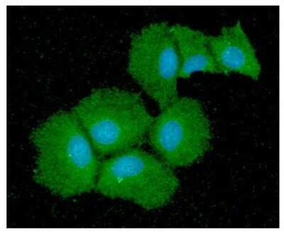 Immunocytochemistry/ Immunofluorescence: QPRT Antibody (24C4) - BSA Free [NBP2-59433]
