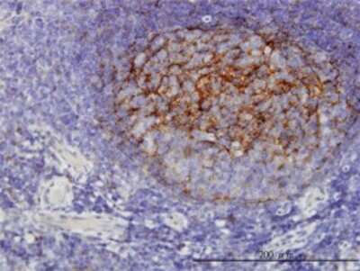 Immunohistochemistry-Paraffin: QPRT Antibody (5D11) [H00023475-M01]