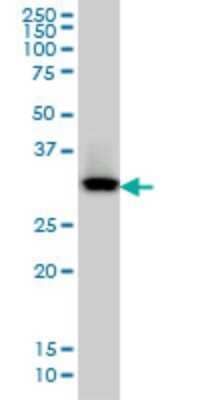 Western Blot: QPRT Antibody (5D11) [H00023475-M01]