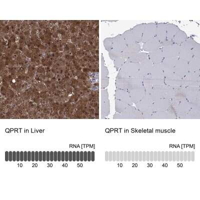 Immunohistochemistry-Paraffin: QPRT Antibody [NBP3-17089]