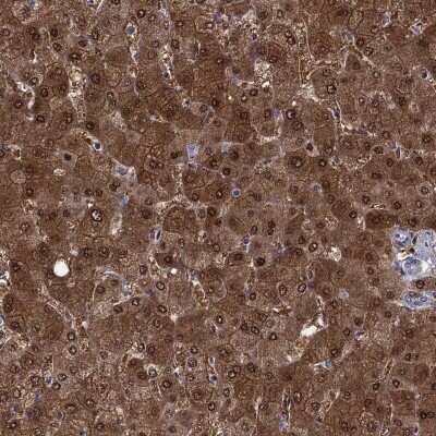 Immunohistochemistry-Paraffin: QPRT Antibody [NBP3-17089]