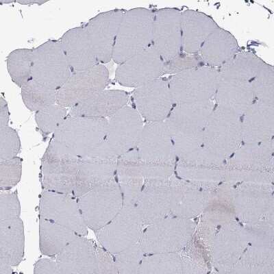 Immunohistochemistry-Paraffin: QPRT Antibody [NBP3-17089]