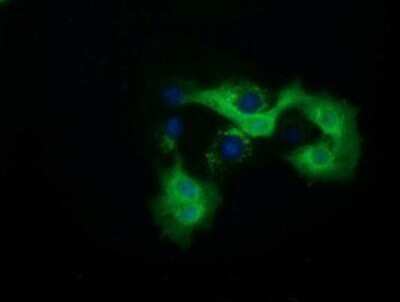 Immunocytochemistry/ Immunofluorescence: QPRT Antibody (OTI1C10) - Azide and BSA Free [NBP2-73761]