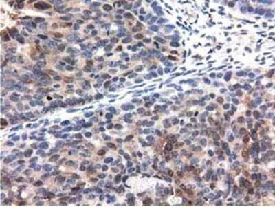 Immunohistochemistry: QPRT Antibody (OTI1C10) - Azide and BSA Free [NBP2-73761]