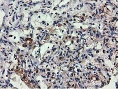 Immunohistochemistry: QPRT Antibody (OTI1C10) - Azide and BSA Free [NBP2-73761]
