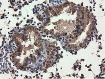 Immunohistochemistry: QPRT Antibody (OTI1C10) - Azide and BSA Free [NBP2-73761]