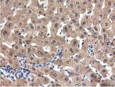 Immunohistochemistry: QPRT Antibody (OTI1C10) - Azide and BSA Free [NBP2-73761]
