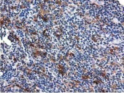 Immunohistochemistry: QPRT Antibody (OTI1C10) - Azide and BSA Free [NBP2-73761]