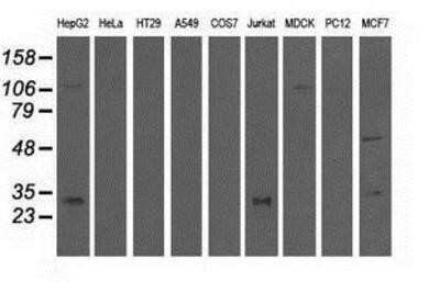 Western Blot: QPRT Antibody (OTI1C10)Azide and BSA Free [NBP2-73761]