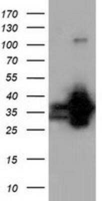 Western Blot: QPRT Antibody (OTI1C10)Azide and BSA Free [NBP2-73761]