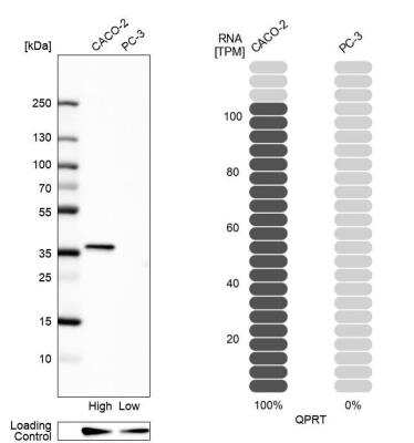 Western Blot: QPRT Antibody [NBP2-30544]