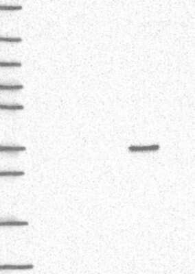 Western Blot: QPRT Antibody [NBP3-17089]