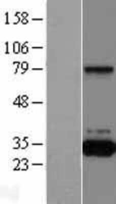 Western Blot: QPRT Overexpression Lysate [NBL1-15030]