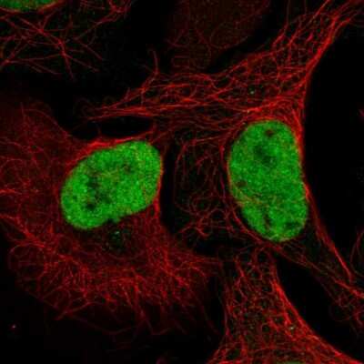 Immunocytochemistry/ Immunofluorescence: QRICH1 Antibody [NBP2-32693]