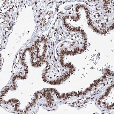 Immunohistochemistry-Paraffin: QRICH1 Antibody [NBP1-82196]