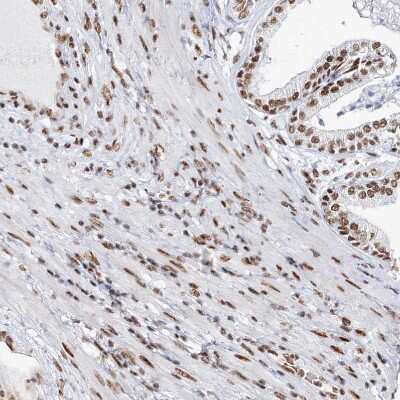 Immunohistochemistry-Paraffin: QRICH1 Antibody [NBP1-82196]