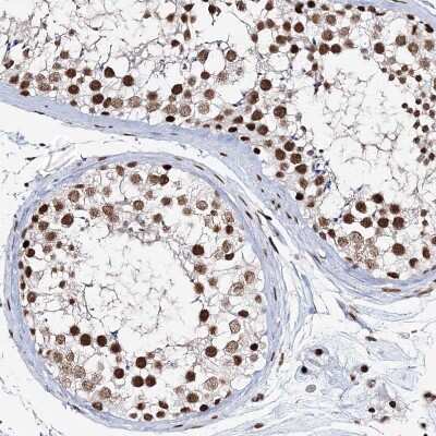 Immunohistochemistry-Paraffin: QRICH1 Antibody [NBP1-82196]