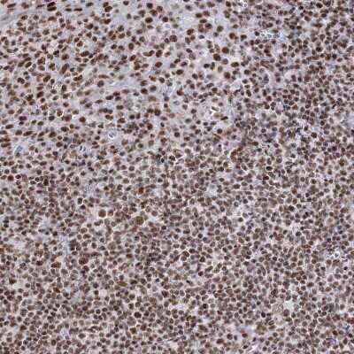 Immunohistochemistry-Paraffin: QRICH1 Antibody [NBP1-82196]