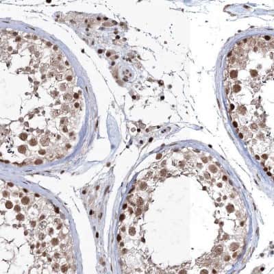 Immunohistochemistry-Paraffin: QRICH1 Antibody [NBP2-32693]