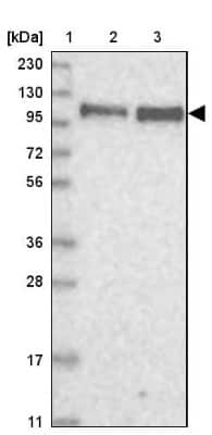 Western Blot: QRICH1 Antibody [NBP1-82196]