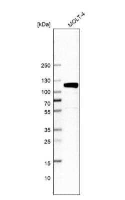 Western Blot: QRICH1 Antibody [NBP1-82196]