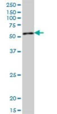 Western Blot: QRSL Antibody [H00055278-B01P]