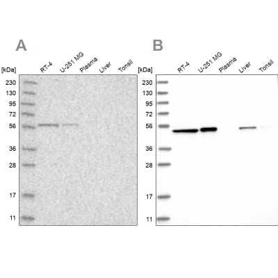 Western Blot: QRSL Antibody [NBP1-87991]