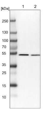 Western Blot: QRSL Antibody [NBP1-87992]