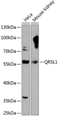 Western Blot: QRSL AntibodyBSA Free [NBP2-94708]