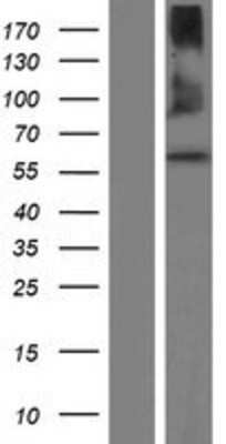 Western Blot: QRSL Overexpression Lysate [NBP2-06822]