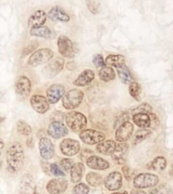 Immunohistochemistry-Paraffin: QSER1 Antibody [NBP1-19112]