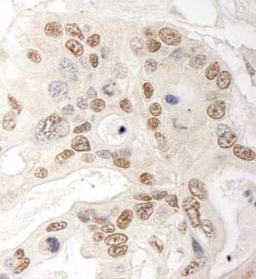 Immunohistochemistry: QSER1 Antibody [NBP1-19113]