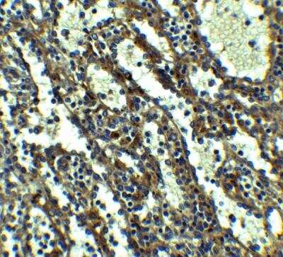 Immunohistochemistry: QSOX1/Quiescin Q6 Antibody - BSA Free [NBP2-81797]