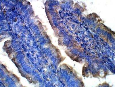 Immunohistochemistry-Paraffin: QSOX1/Quiescin Q6 Antibody [NBP3-12338]