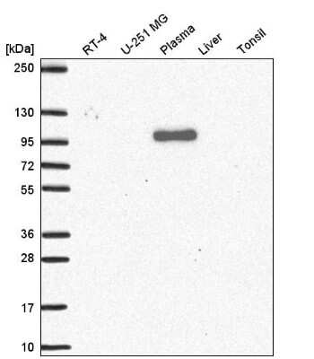 Western Blot: QSOX1/Quiescin Q6 Antibody [NBP2-55409]