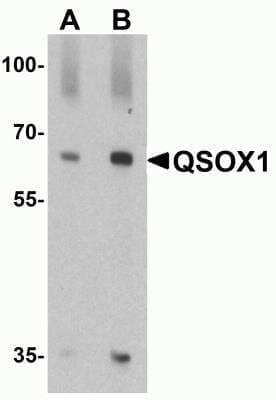 Western Blot: QSOX1/Quiescin Q6 AntibodyBSA Free [NBP2-81797]