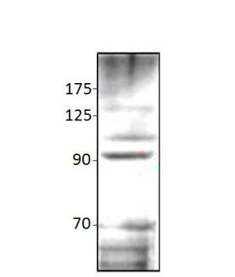 Western Blot: QSOX1/Quiescin Q6 Antibody [NBP3-12338]